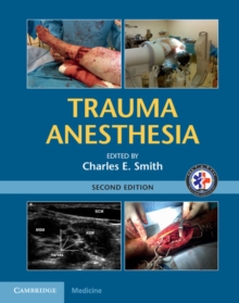 Trauma Anesthesia