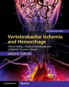 Vertebrobasilar Ischemia and Hemorrhage : Clinical Findings, Diagnosis and Management of Posterior Circulation Disease