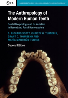 Anthropology of Modern Human Teeth : Dental Morphology and its Variation in Recent and Fossil Homo sapiens