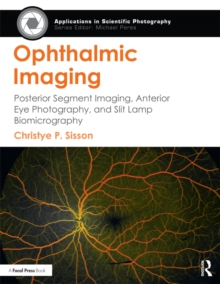 Ophthalmic Imaging : Posterior Segment Imaging, Anterior Eye Photography, and Slit Lamp Biomicrography