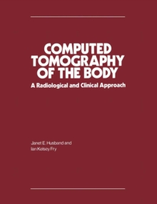 Computed Tomography of the Body : A Radiological and Clinical Approach