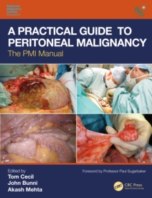 A Practical Guide to Peritoneal Malignancy : The PMI Manual