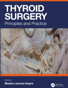 Thyroid Surgery : Principles and Practice