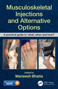 Musculoskeletal Injections and Alternative Options : A practical guide to 'what, when and how?'