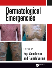 Dermatological Emergencies