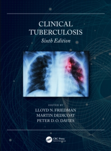 Clinical Tuberculosis