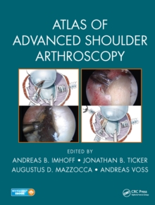 Atlas of Advanced Shoulder Arthroscopy