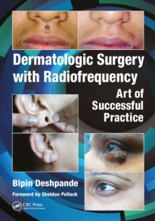 Dermatologic Surgery with Radiofrequency : Art of Successful Practice