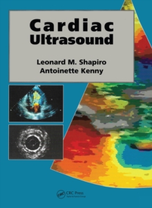 Cardiac Ultrasound