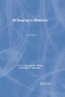 3D Imaging in Medicine, Second Edition