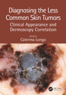 Diagnosing the Less Common Skin Tumors : Clinical Appearance and Dermoscopy Correlation