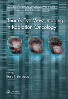 Beam's Eye View Imaging in Radiation Oncology