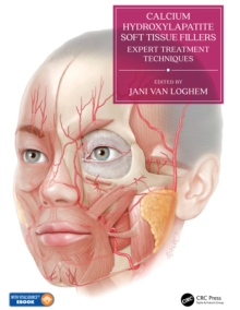 Calcium Hydroxylapatite Soft Tissue Fillers : Expert Treatment Techniques