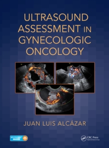 Ultrasound Assessment in Gynecologic Oncology