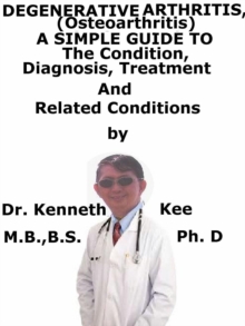 Degenerative Arthritis (Osteoarthritis) A Simple Guide To The Condition, Diagnosis, Treatment And Related Conditions