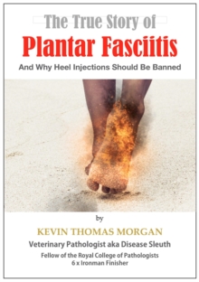 True Story of Plantar Fasciitis: And Why Heel Injections Should Be Banned