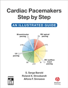 Cardiac Pacemakers Step by Step : An Illustrated Guide