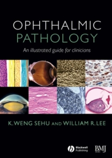 Ophthalmic Pathology : An Illustrated Guide for Clinicians