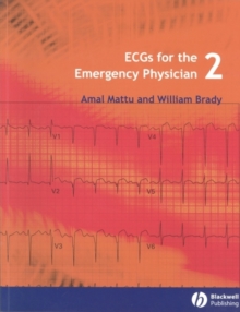 ECGs for the Emergency Physician 2, Paperback / softback Book ECGs for the Emergency Physician 2, Paperback / softback Book