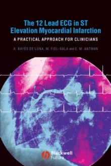 The 12 Lead ECG in ST Elevation Myocardial Infarction : A Practical Approach for Clinicians