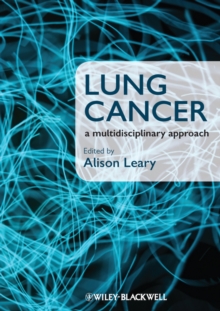 Lung Cancer : A Multidisciplinary Approach, Paperback Book Lung Cancer : A Multidisciplinary Approach, Paperback Book