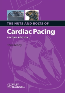 The Nuts and Bolts of Cardiac Pacing 2e, Paperback / softback Book The Nuts and Bolts of Cardiac Pacing 2e, Paperback / softback Book