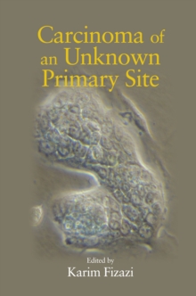 Carcinoma of an Unknown Primary Site