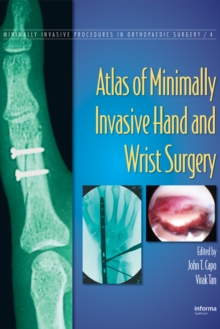 Atlas of Minimally Invasive Hand and Wrist Surgery