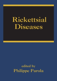 Rickettsial Diseases