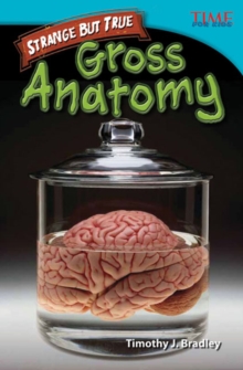 Strange but True: Gross Anatomy : Gross Anatomy