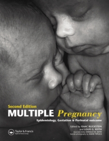 Multiple Pregnancy : Epidemiology, Gestation, and Perinatal Outcome