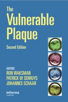 Handbook of the Vulnerable Plaque