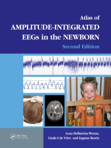 An Atlas of Amplitude-Integrated EEGs in the Newborn