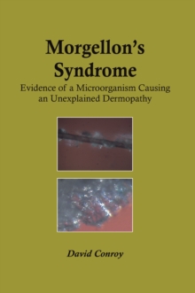 Morgellon's Syndrome