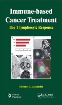 Immune-based Cancer Treatment : The T Iymphocyte Response