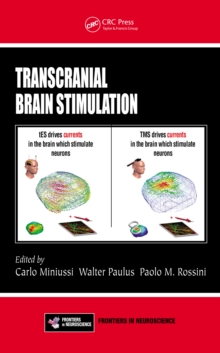 Transcranial Brain Stimulation