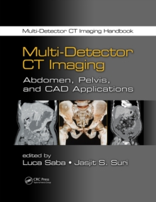 Multi-Detector CT Imaging : Abdomen, Pelvis, and CAD Applications