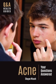 Acne : Your Questions Answered