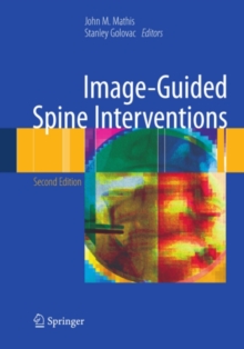 Image-Guided Spine Interventions