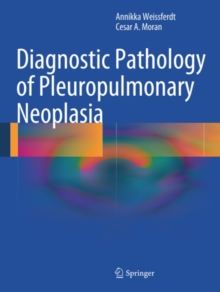 Diagnostic Pathology of Pleuropulmonary Neoplasia