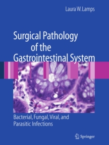 Surgical Pathology of the Gastrointestinal System: Bacterial, Fungal, Viral, and Parasitic Infections