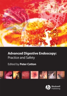 Advanced Digestive Endoscopy : Practice and Safety