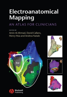 Electroanatomical Mapping : An Atlas for Clinicians