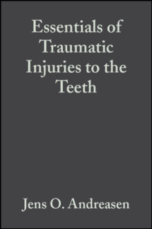 Essentials of Traumatic Injuries to the Teeth : A Step-by-Step Treatment Guide