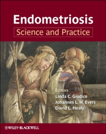 Endometriosis : Science and Practice