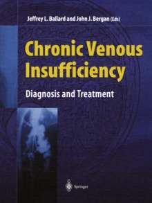 Chronic Venous Insufficiency : Diagnosis and Treatment