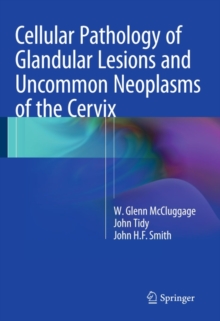 Cellular Pathology of Glandular Lesions and Uncommon Neoplasms of the Cervix