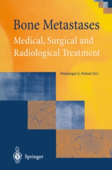 Bone Metastases : Medical, Surgical and Radiological Treatment