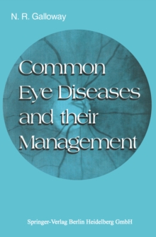 Common Eye Diseases and Their Management