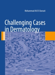 Challenging Cases in Dermatology